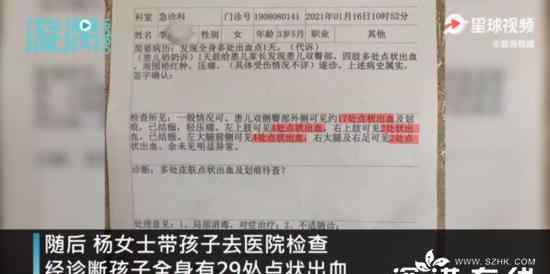 幼儿园3岁女童身上现29处针眼 到底是什么状况？