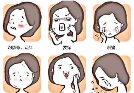 冬季皮炎 冬季皮炎反复发作，这几个生活细节要注意！文章配图
