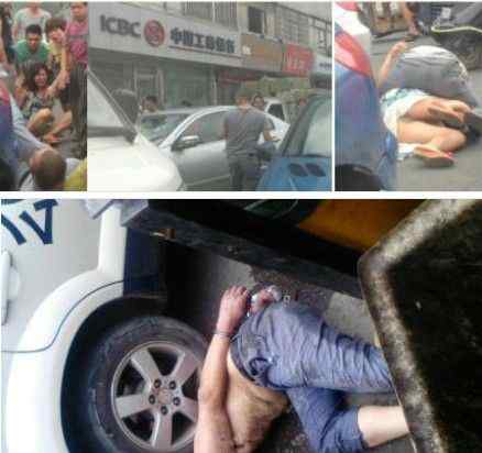 温州啃脸男 温州惊现啃脸男：无辜女子被咬得血肉模糊/图