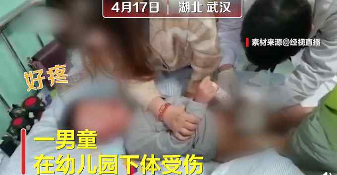 官方回应“男童自称被老师剪下体” 警方查看监控发现问题