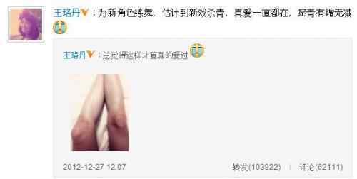 真爱体 王珞丹"真爱体"走红 被指“太有内涵了”