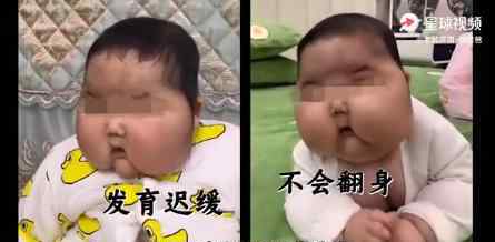 5月大婴儿用抑菌霜后成大头娃娃 到底是怎么回事