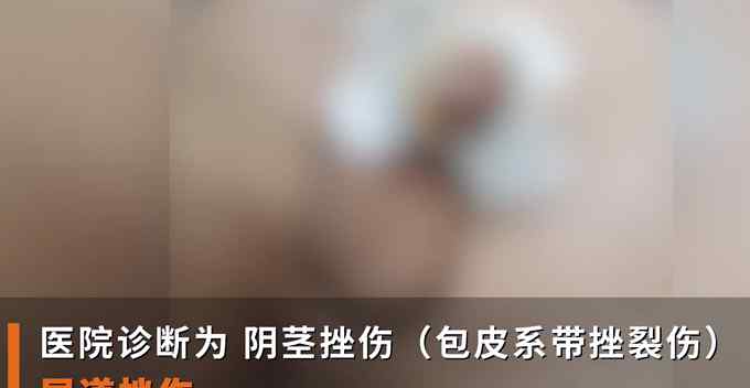 男童被老师剪伤下体？警方称现有证据证明无犯罪事实发生 家长期待真相