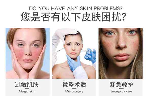 医用冷敷贴面膜的作用 医用冷敷贴到底有多好用