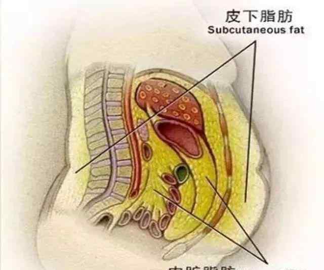 内脏脂肪最怕两种食物 内脏脂肪多，容易引发3大疾病！吃4种内脏脂肪克星食物脂肪掉的快