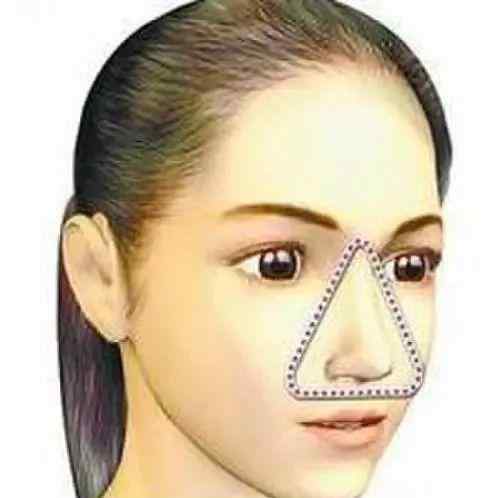 姨妈痘痘怎么调理 熬夜痘、姨妈痘、上火痘、压力痘……怎么急救？