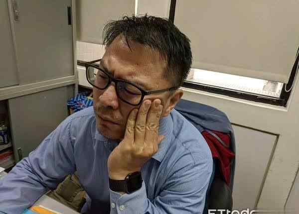 蛀齿 左上颚拔蛀齿无效 竟是脑干长怪物