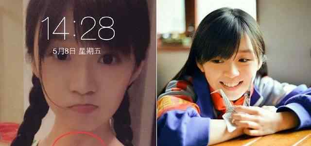 宋伊人脖子上的疤痕 宋伊人脖子上的疤痕 宋伊人自曝疤痕来源
