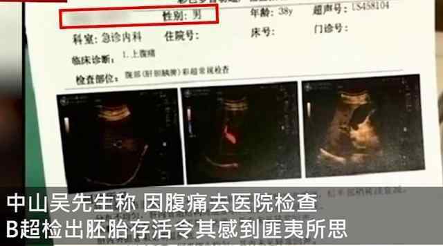 男子腹痛查B超检出宫内胚胎存活 真相来了!原来是这样