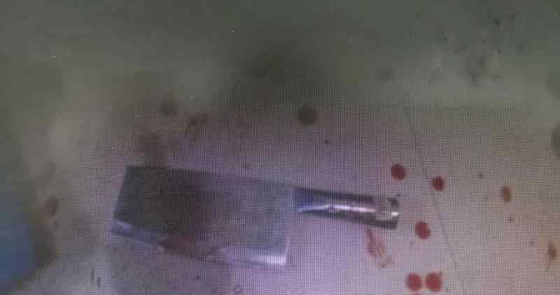 男子被妻子情夫暴砍 俩小偷拼死相救！这样的剧情连编剧都写不出来