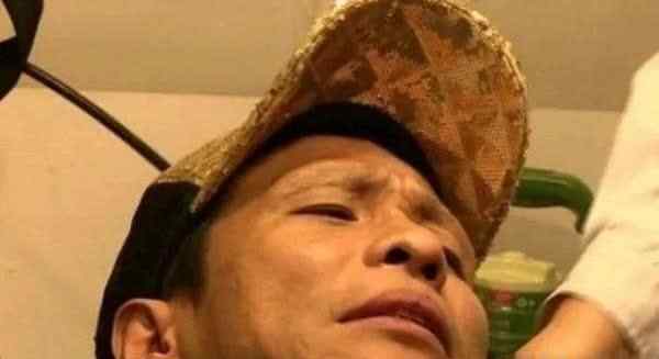 宋小宝什么病 宋小宝病情再度恶化？娱乐圈可能一退不返，他现状太让人心疼