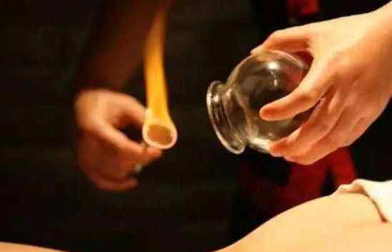 男子拔火罐被火烧 这也太不小心了吧