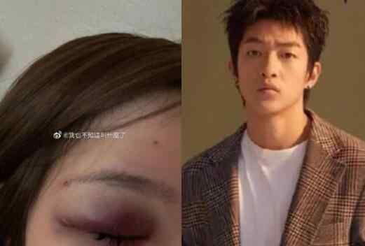 疑屈楚萧女友发文控诉家暴打胎 已经不是第一次了