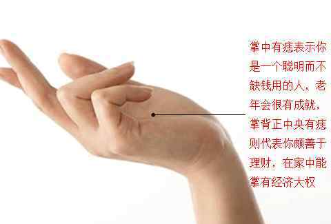 掌心有痣 男女掌心长痣代表什么