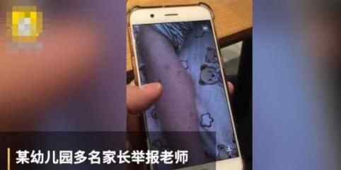 老师牙签扎幼童 可恶至极真相实在太气人