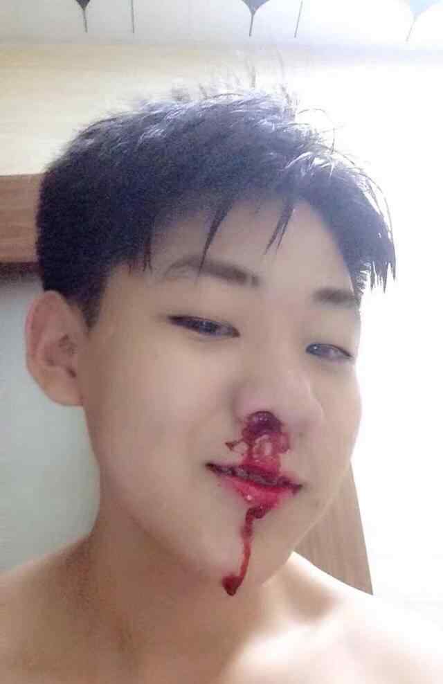 流鼻血的表情包 流鼻血的表情包|我觉得挺一般的