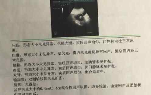 手术做一半无肿瘤 这不是坑人吗？