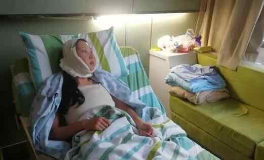 应聘模特被骗整形 悲剧真相是这样实在让人震惊