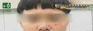 打篮球被抓成花脸 原因是这样简直太惨了