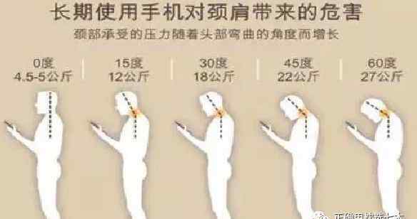 颈椎病成因 4种原因导致颈椎病，用七木枕，轻松解决