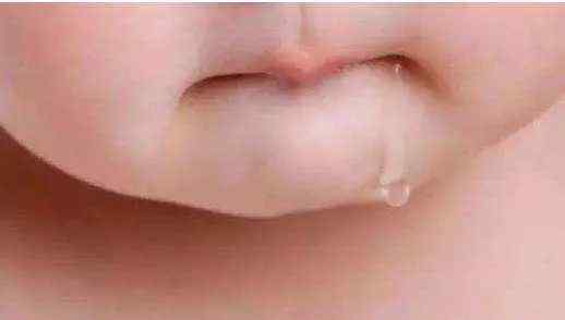 宝宝口水疹用什么药膏 婴儿口水疹的处理，这才是最科学的方法！快收藏