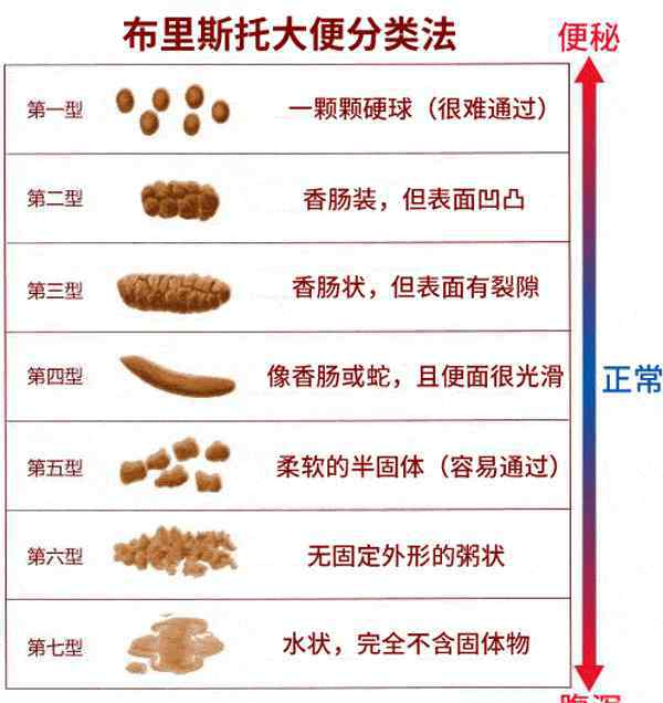大便不成形怎么办 大便不成形一定是肠癌吗？别慌，医生告诉你怎么办！