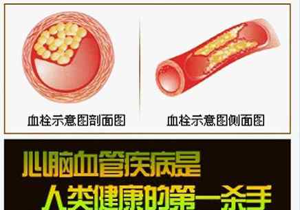 血清总胆固醇偏高 血清总胆固醇正常值，看完不用再问医生了