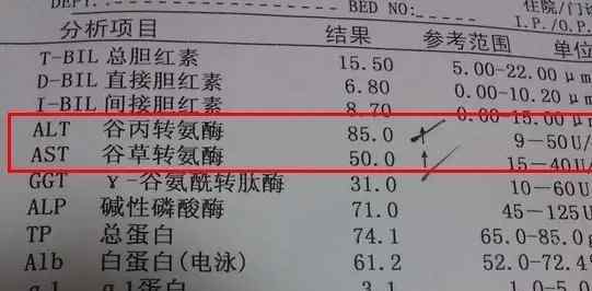 降转氨酶最快的方法 转氨酶高至180？肝脏受损严重，用1个方法，转氨酶降得快