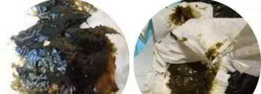 奶瓣屎图片 一图详解宝宝便便隐藏的健康问题，看完再也不用去群里发屎图了