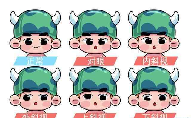 婴儿斗鸡眼 为什么宝宝的眼睛看起来像斗鸡眼，儿科医生却说不用担心？