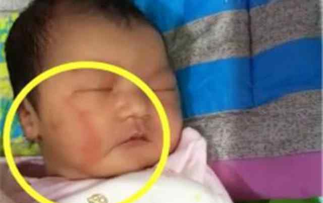 产钳 “大夫，我能换个姿势吗？”宝妈这句话，为宝宝免去“产钳”之苦