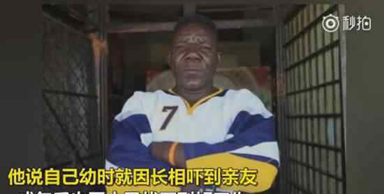 世界上最丑的男人 世界最丑男人William Masvinu资料照片