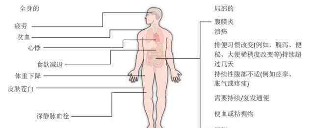 肠癌早期症状 早期肠癌症状不明显，一旦出现3种信号就要警惕，早发现早安全