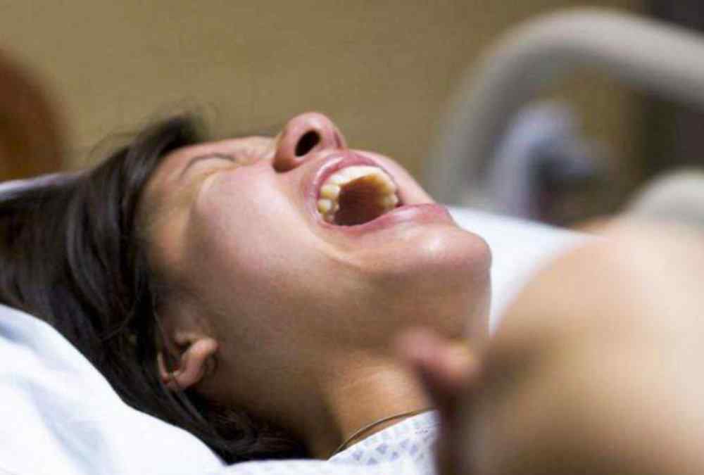 产钳 “大夫，我能换个姿势吗？”宝妈这句话，为宝宝免去“产钳”之苦