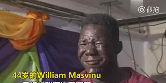 世界上最丑的男人 世界最丑男人William Masvinu资料照片