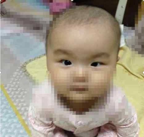 婴儿斗鸡眼 为什么宝宝的眼睛看起来像斗鸡眼，儿科医生却说不用担心？