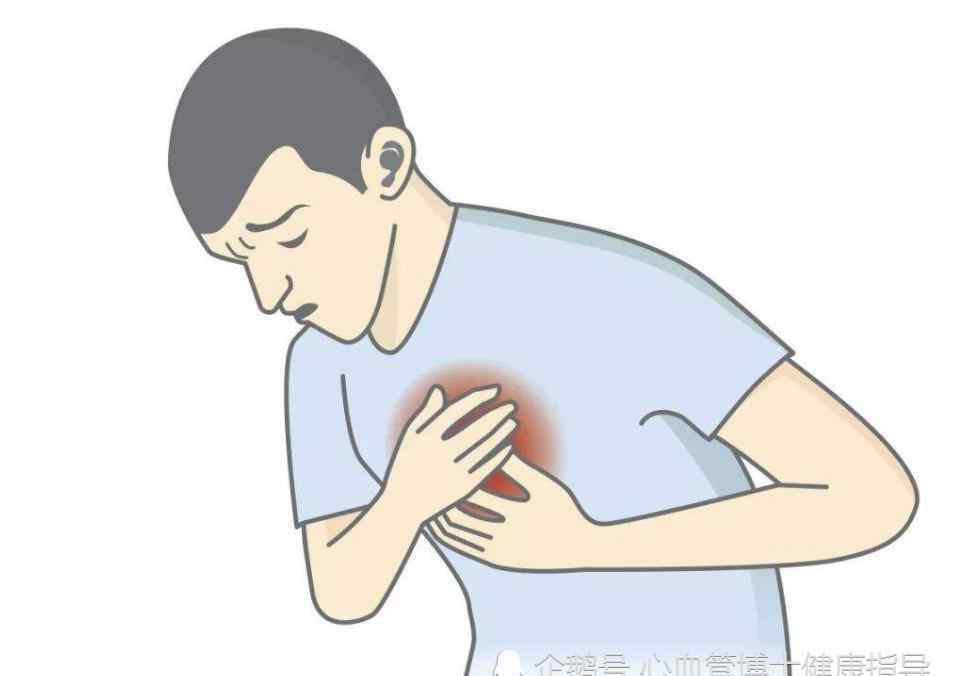 哪些人容易心源性猝死 为什么年轻人会出现心源性猝死