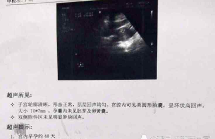 hcg下降后奇迹上升 两次流产经历告诉你，孕早期“HCG翻倍”有多重要