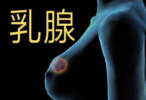 双侧乳腺增生 双侧乳腺增生是怎么引起的？为了老婆，男人得看了