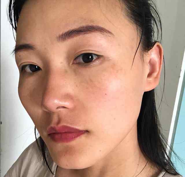 色斑中医 老中医：长了黄褐斑不用怕，坚持做好这3点，色斑排出、面容干净