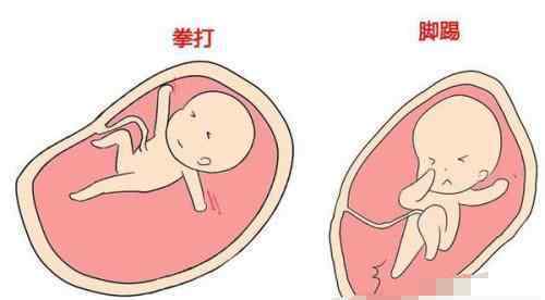 怎么分辨胎动和肠蠕动 孕期胎动、肠胃蠕动和宫缩之间有什么区别？