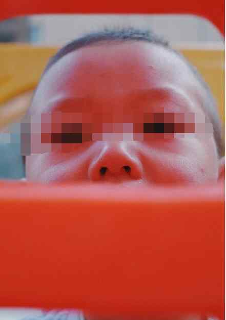 小孩鼻屎多是什么原因 有人说小孩吃鼻屎聪明真假，那么大人吃鼻屎是什么原因？