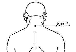 落枕穴位 落枕后脖子酸痛，可按摩这些穴位来缓解