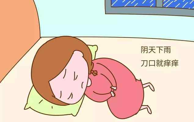 刀疤怎么抓 痒！剖腹产刀疤痒怎么办，剖腹产如何护理伤口