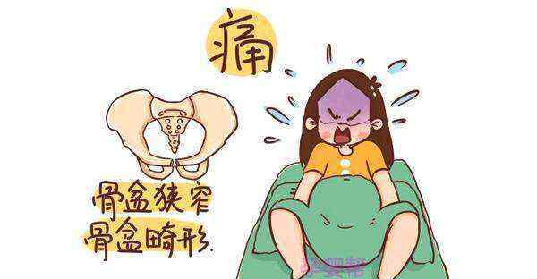 臀位能顺产吗 臀位，一般情况下还能顺产吗？