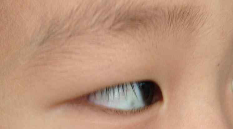 白眼球有黑点 眼白有黑点是被下符咒吗，如何知道自己中了巫术？