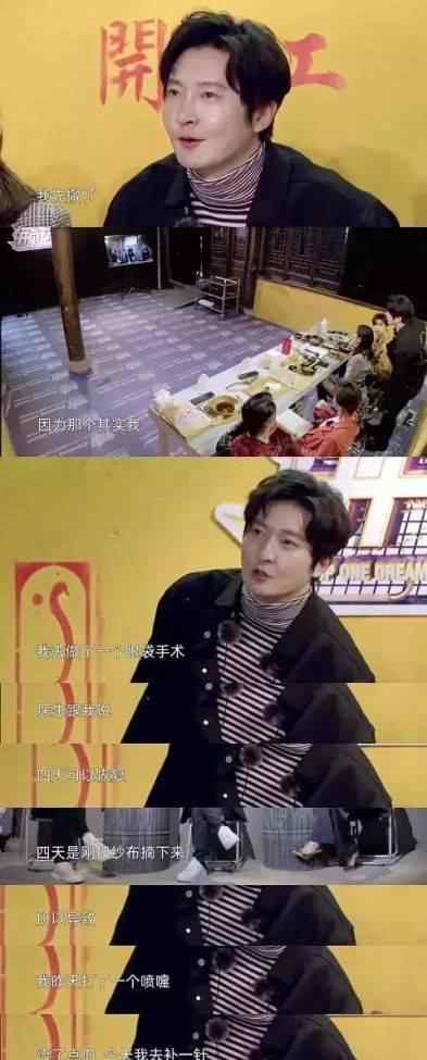 去除针哏的小妙招 割完眼袋打个喷嚏线崩了，郭京飞真是长在我笑点上的男人