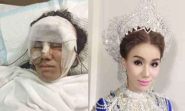丑男变美女 丑男变性整容成美女 还嫁给小自己11岁的小鲜肉富二代