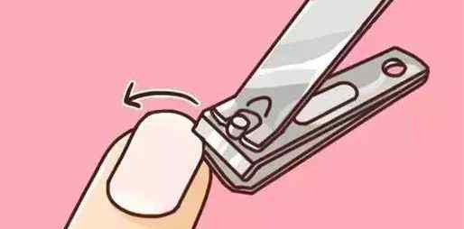 甲沟炎应该怎么办 得了甲沟炎该怎么办吗？学会穿鞋很重要