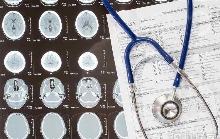 照ct对身体有害吗 照一次CT，对人体的伤害有多大？会致癌吗？终于有医生说了真话